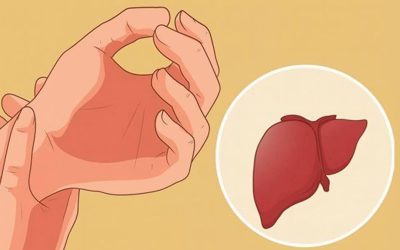 Une maladie du foie ne provoque pas de douleur, mais il existe 5 symptômes qui peuvent indiquer un problème hépatique.