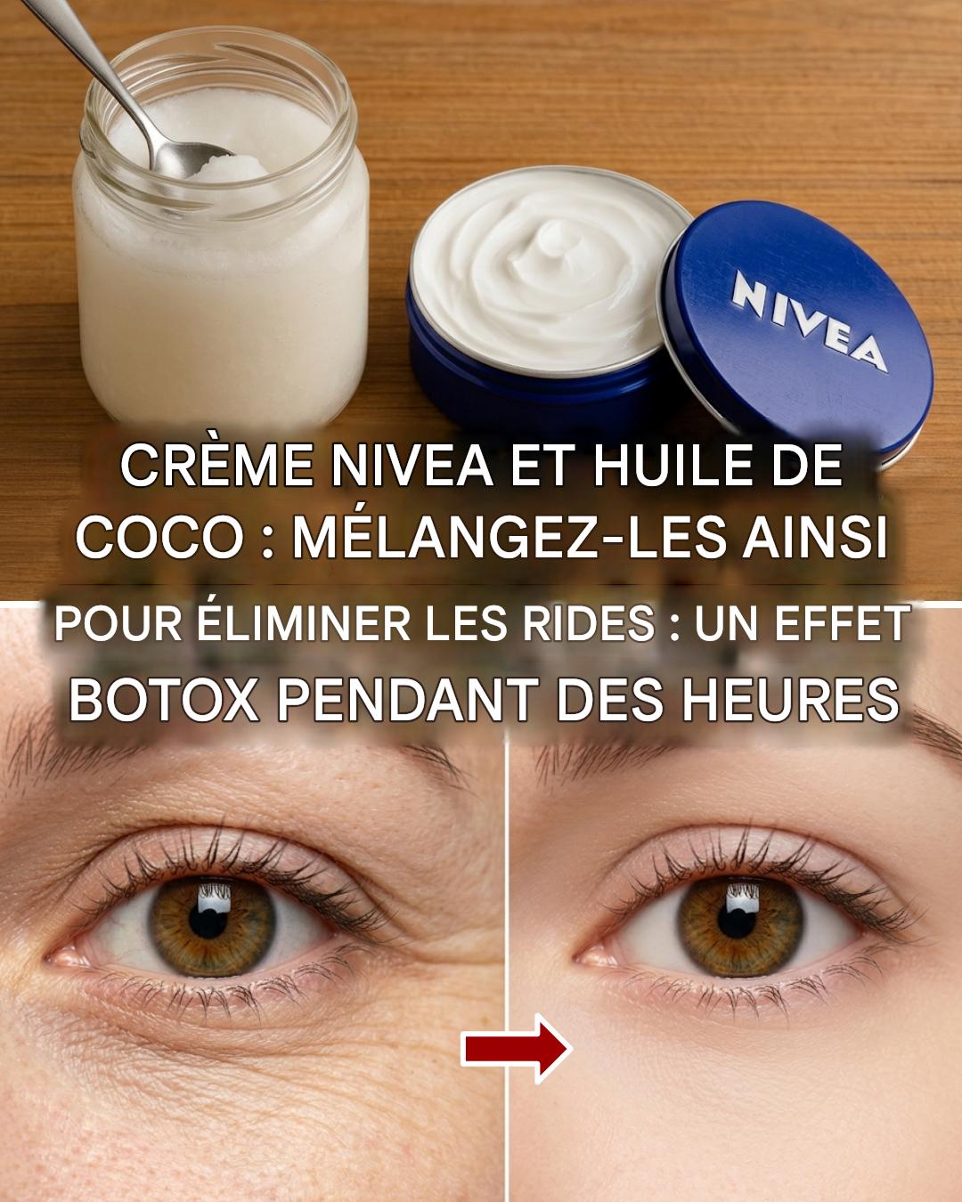 Comment associer l’huile de coco et la crème Nivea pour atténuer les rides et les ridules d’expression