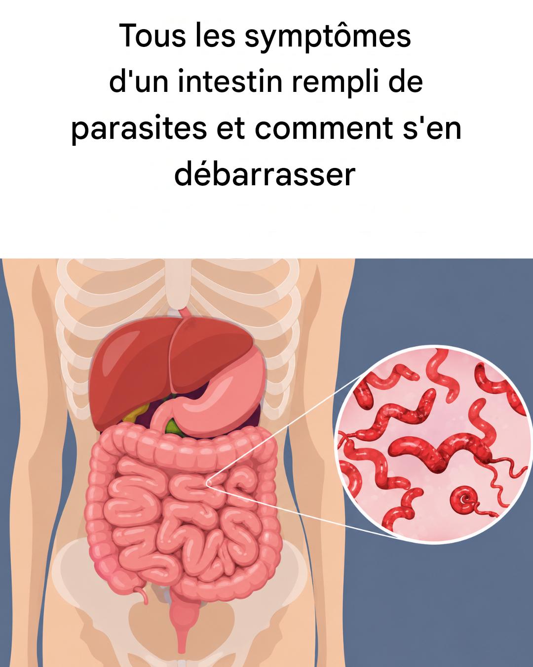 Tous les symptômes d’un intestin infesté de parasites et que faire pour y remédier