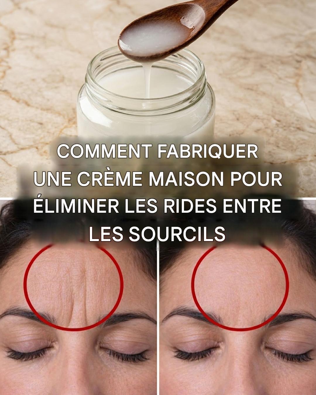 2 masques pour éliminer les ridules entre les sourcils