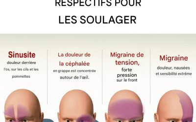 Types de maux de tête et leurs remèdes naturels respectifs pour les soulager instantanément