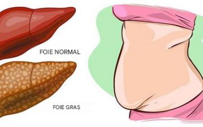 8 aliments qui brûlent et éliminent les graisses du foie