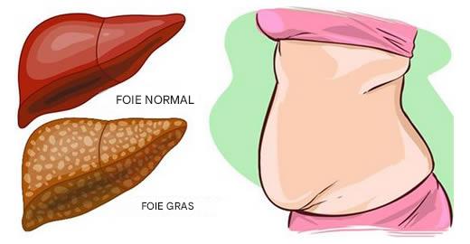 8 aliments qui brûlent et éliminent les graisses du foie