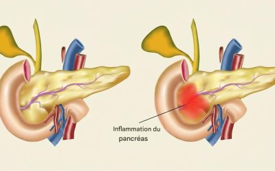 8 symptômes d’un pancréas qui ne fonctionne pas correctement et que faire