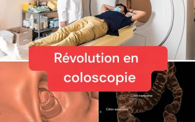 Nouvelle méthode : la coloscopie ne sera plus un examen invasif.(1/2)