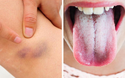 11 signes que votre corps vous envoie des avertissements importants