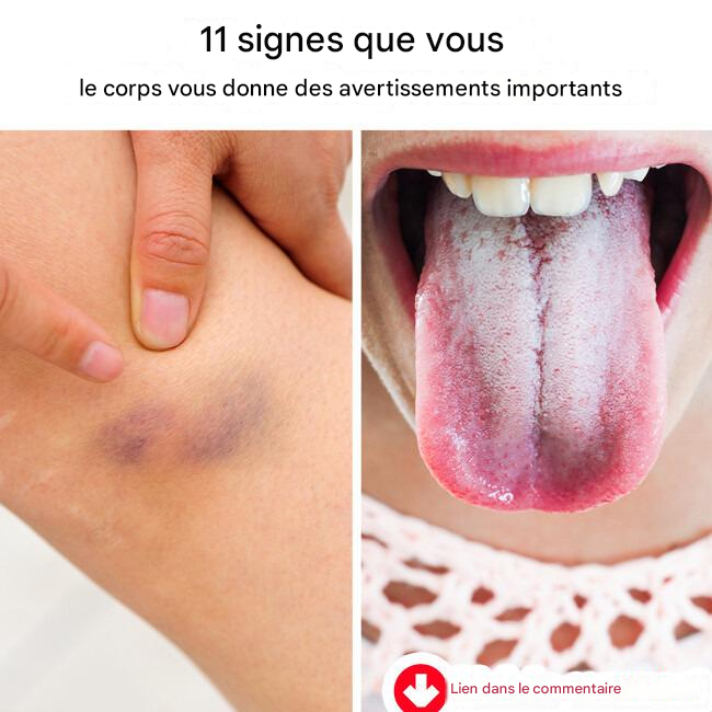 11 signes que votre corps vous envoie des avertissements importants