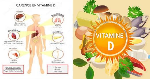 Tous les symptômes d’une carence en vitamine D et ce que vous devez faire pour y remédier