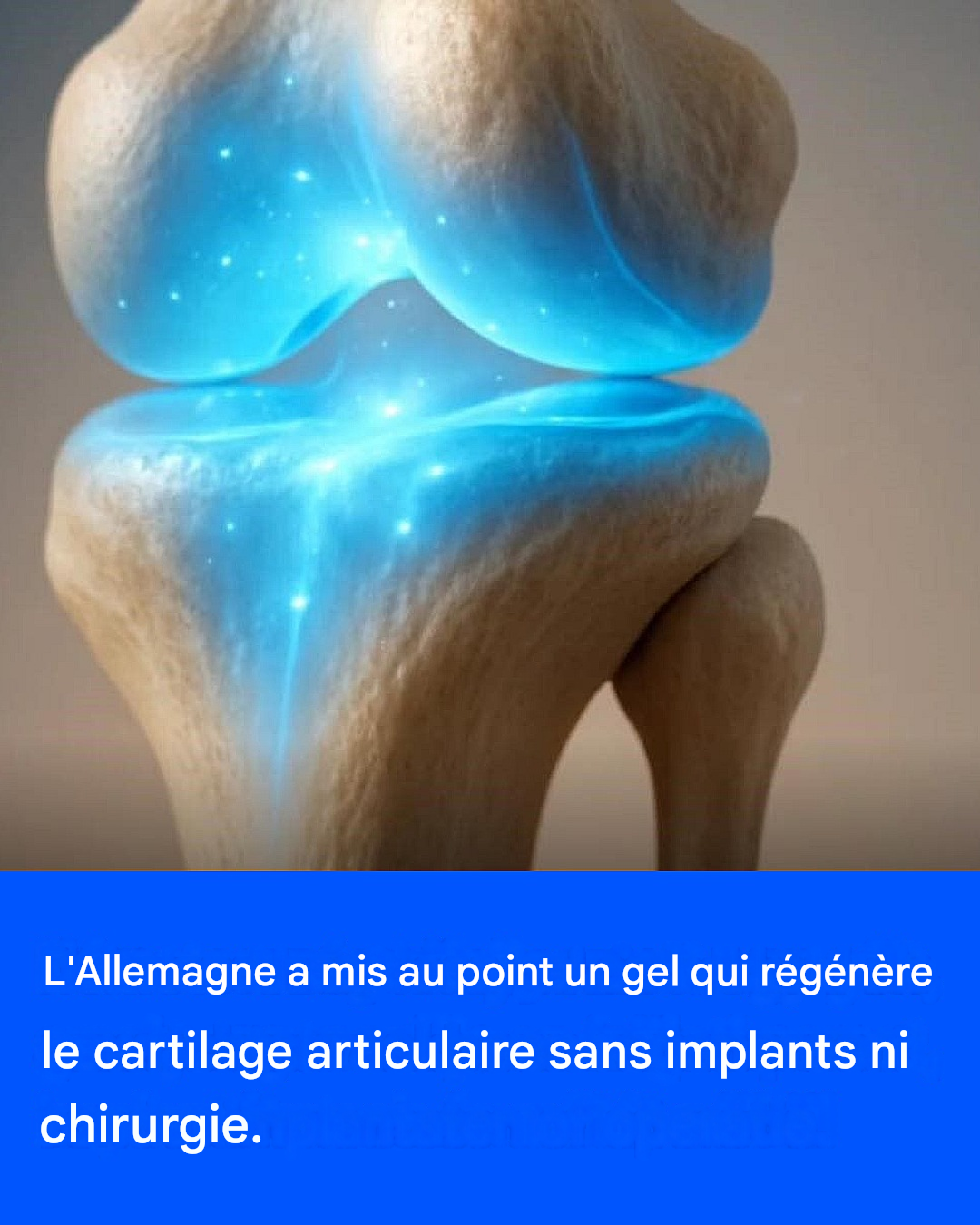 L’Allemagne a mis au point un gel qui régénère le cartilage articulaire sans implants ni chirurgie.