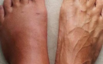 Un mois avant une crise cardiaque, votre corps propage 7 menaces dangereuses.