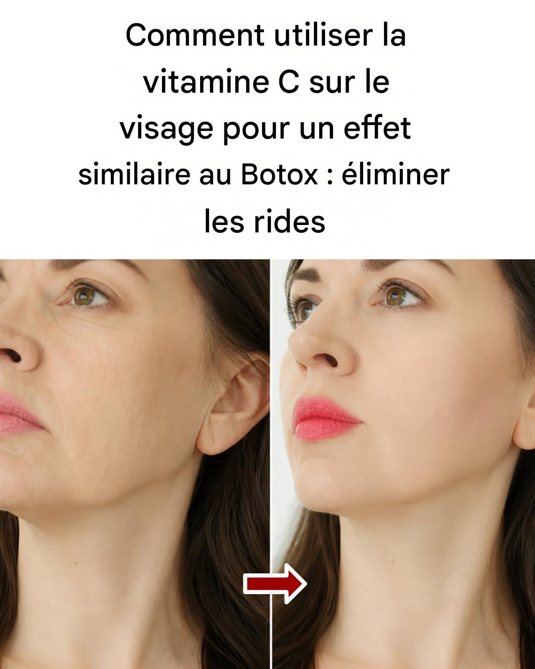 Comment utiliser la vitamine C sur le visage pour obtenir un effet Botox