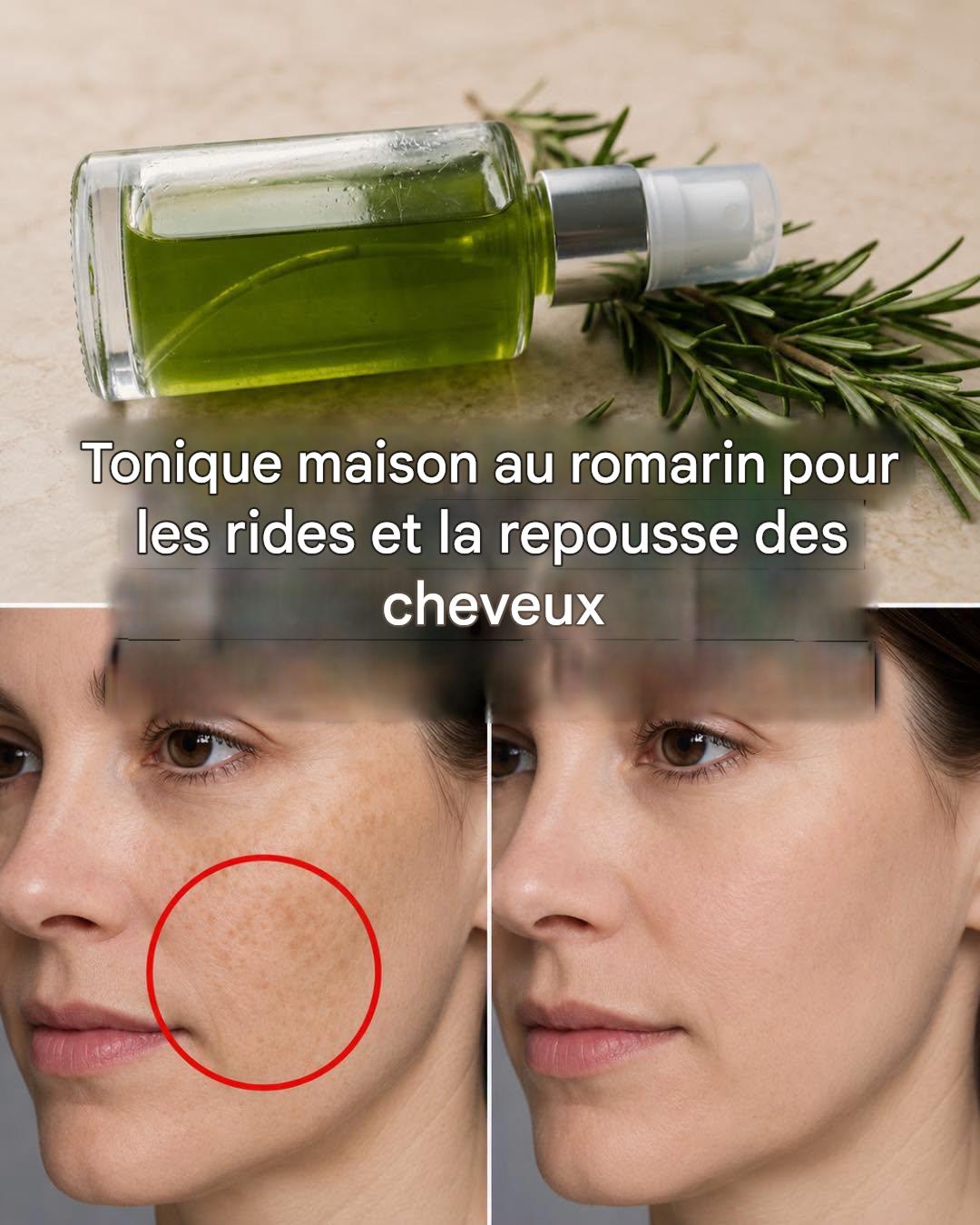 Lotion tonique au romarin pour éliminer les rides et les imperfections cutanées