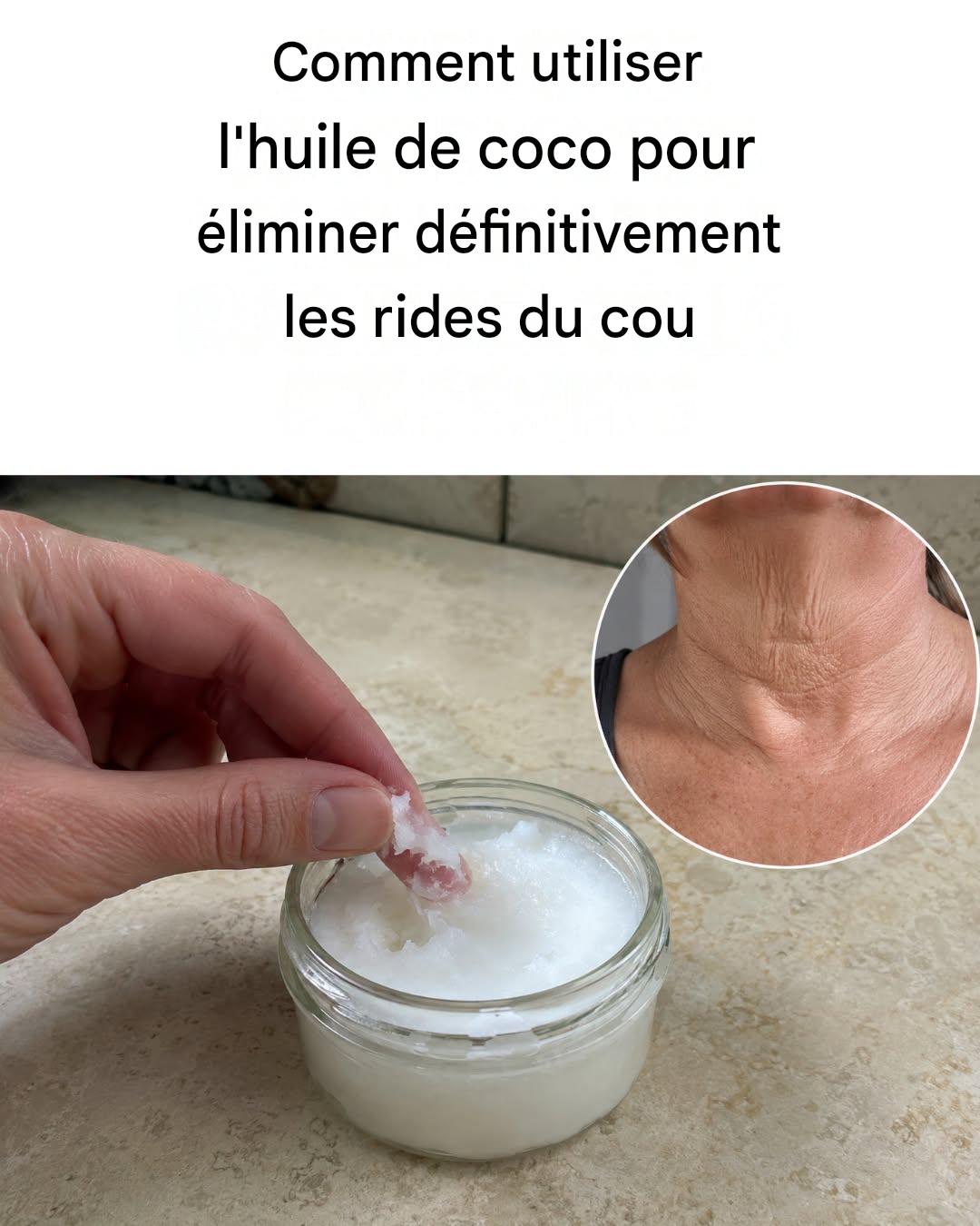 Comment utiliser l’huile de coco pour éliminer les rides du cou