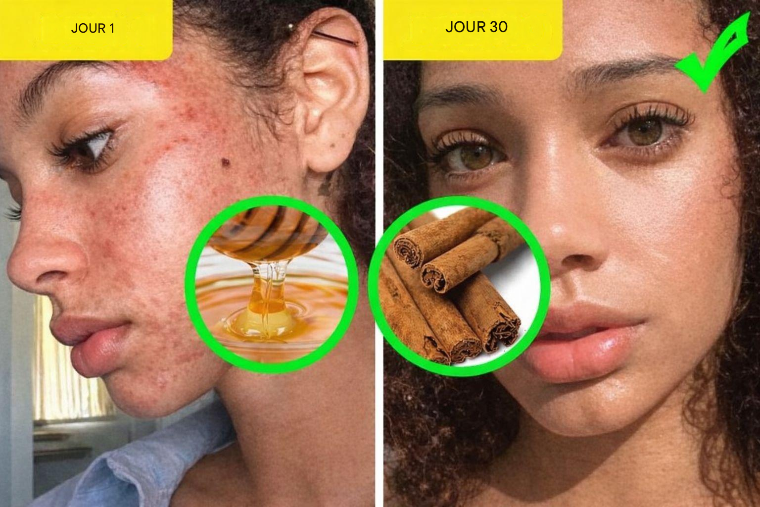 6 problèmes de peau courants et 6 masques efficaces à utiliser chez soi pour y remédier.