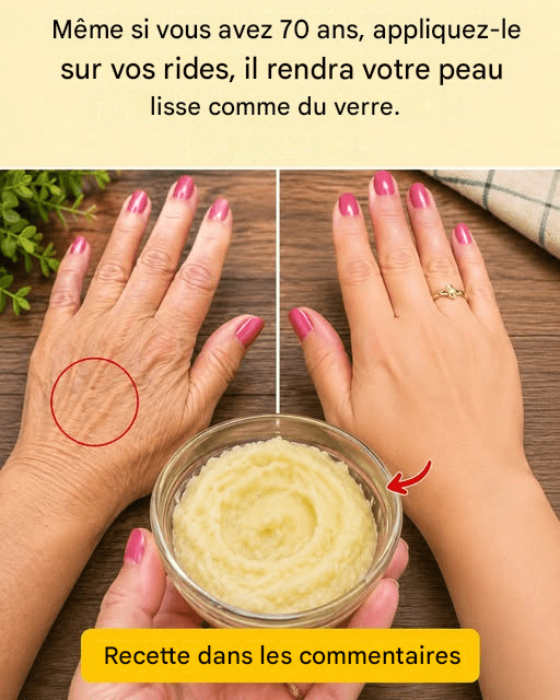 Préparez la crème au bicarbonate de soude et appliquez-la avant de vous coucher. Adieu rides et imperfections… Lire la suite. Pour continuer à