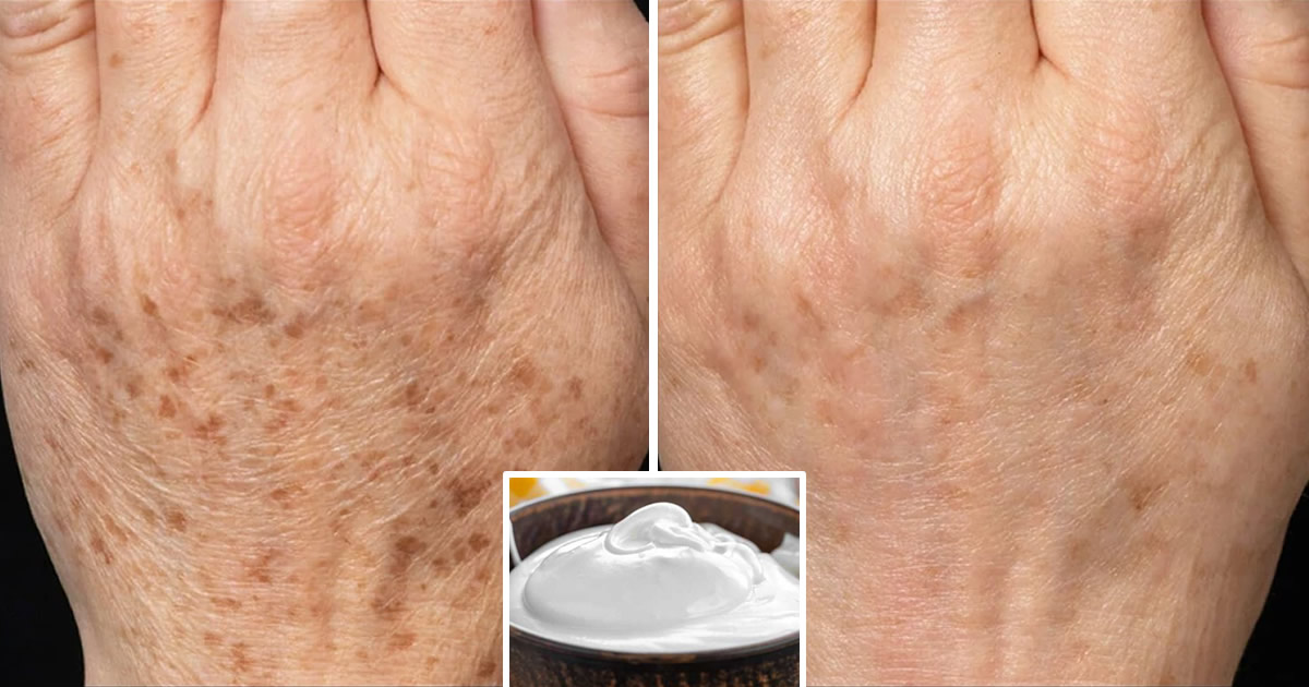 Comment fabriquer un masque au blanc d’œuf pour rajeunir vos mains de 15 ans