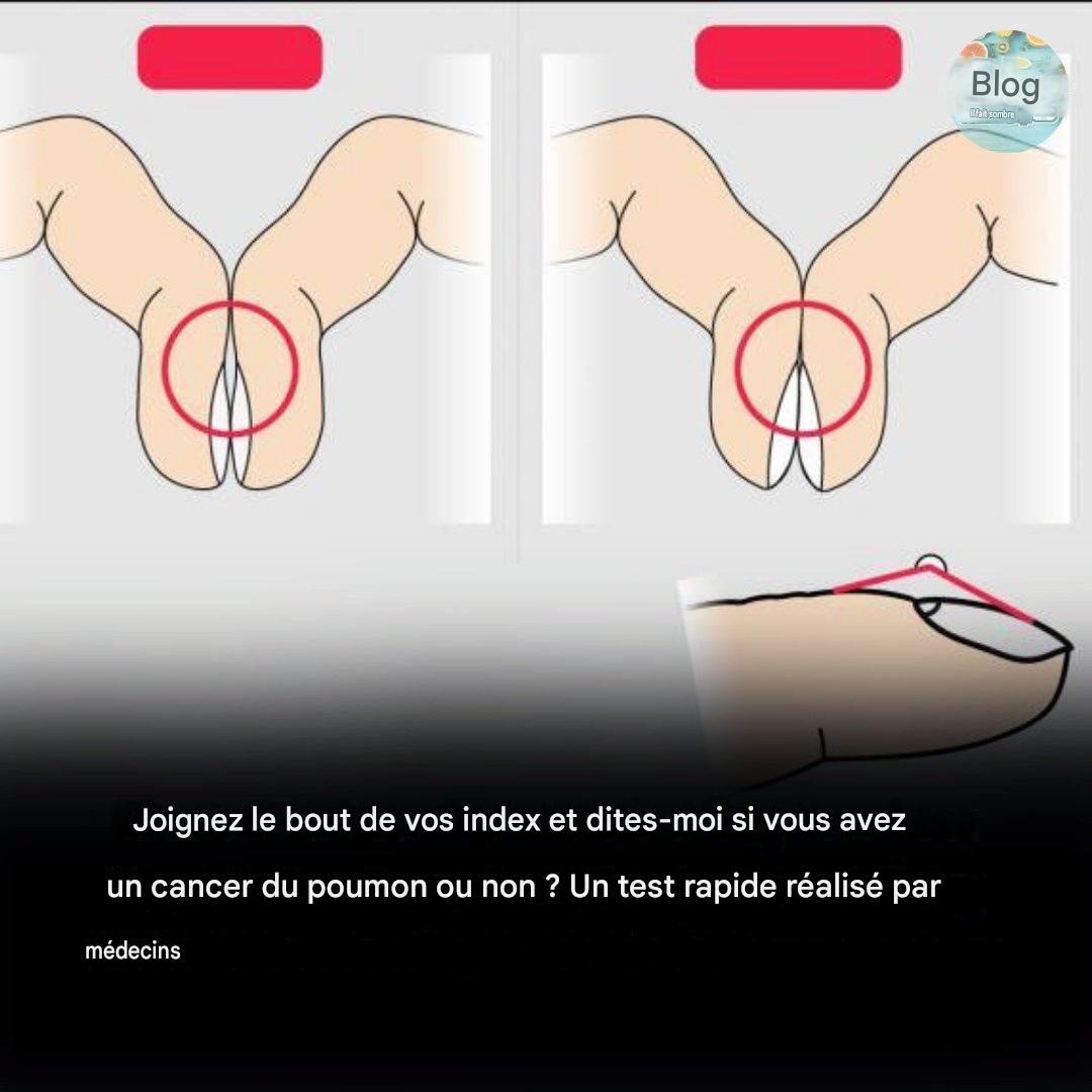 Rapprochez le bout de vos index l’un de l’autre.