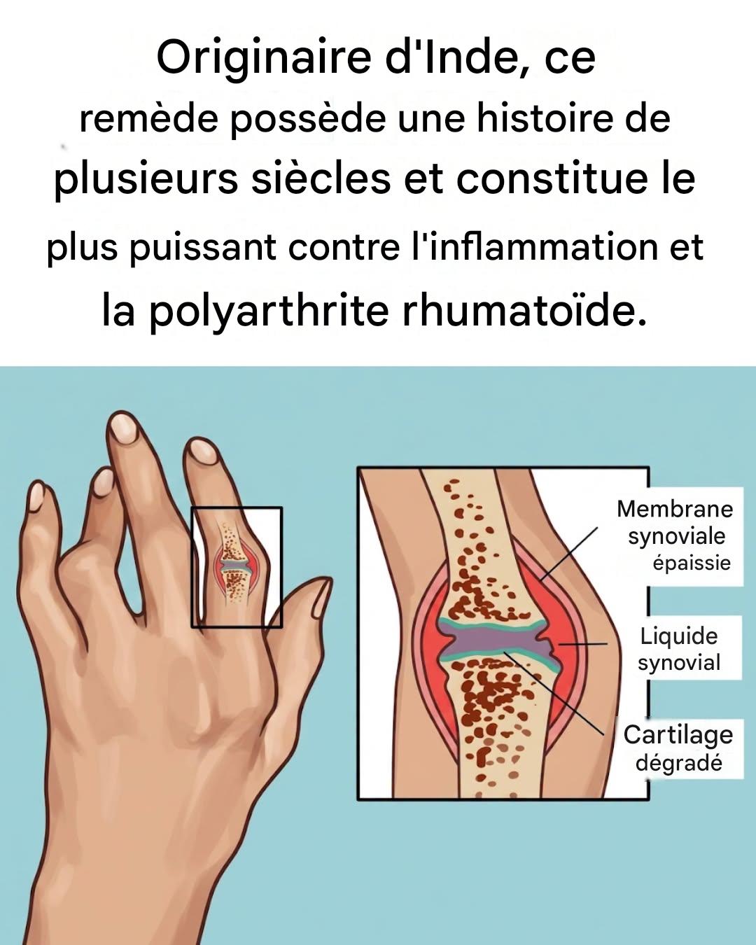Un remède indien ancestral qui soigne l’inflammation et l’arthrite rhumatoïde