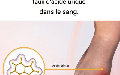 8 aliments qui font baisser le taux d’acide urique