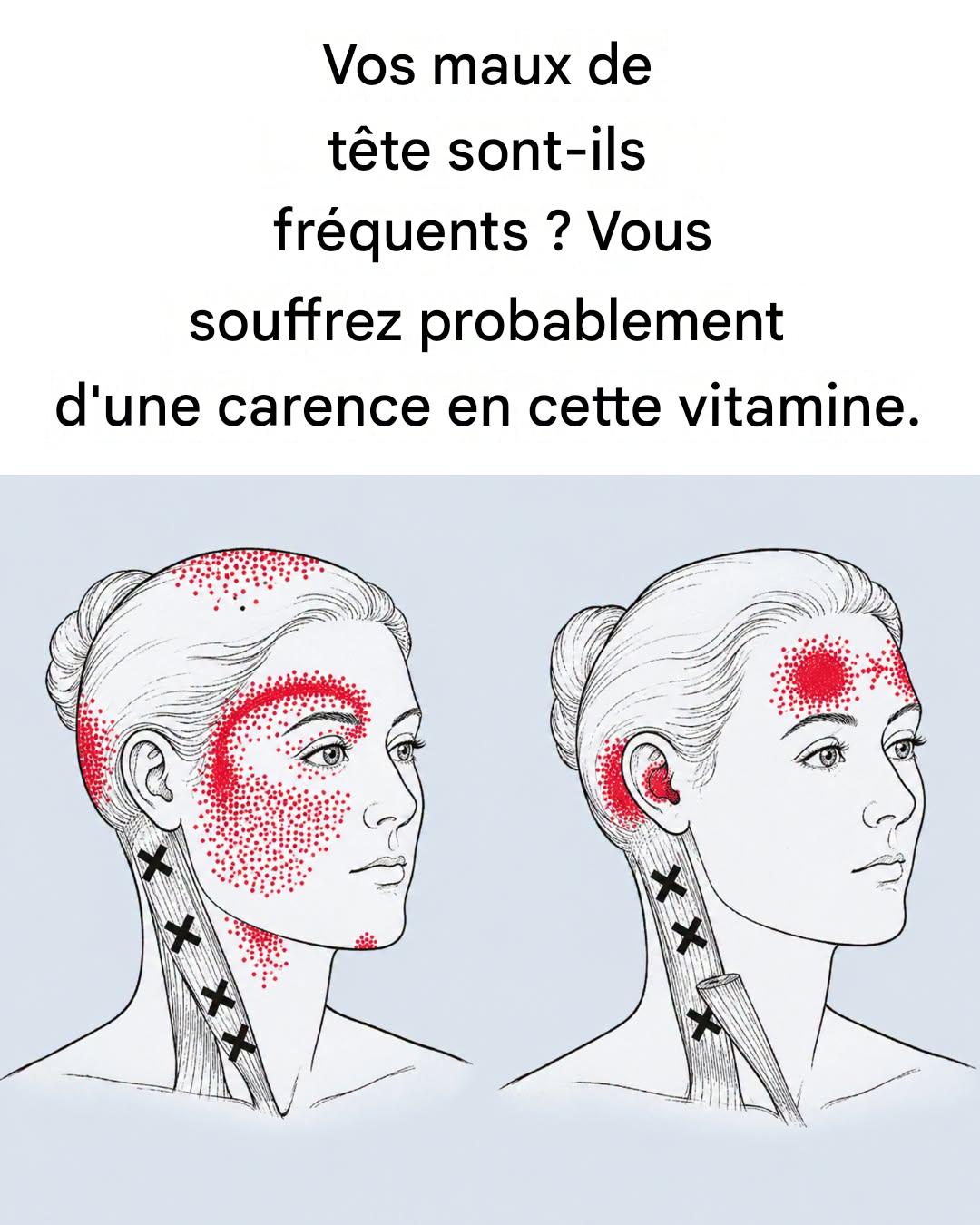 Une carence en cette vitamine pourrait être la cause de maux de tête fréquents.