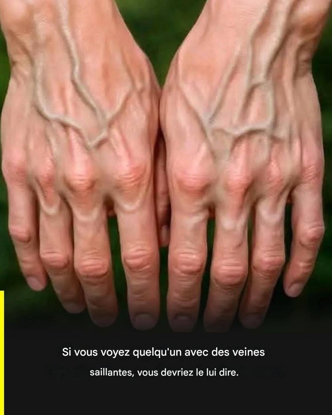 Si vos veines sont visibles, cela signifie que… Voir plus