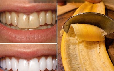 Des dentistes secrets que vous préféreriez ne pas rencontrer : éliminent le tartre et blanchissent vos dents en seulement 2 minutes.