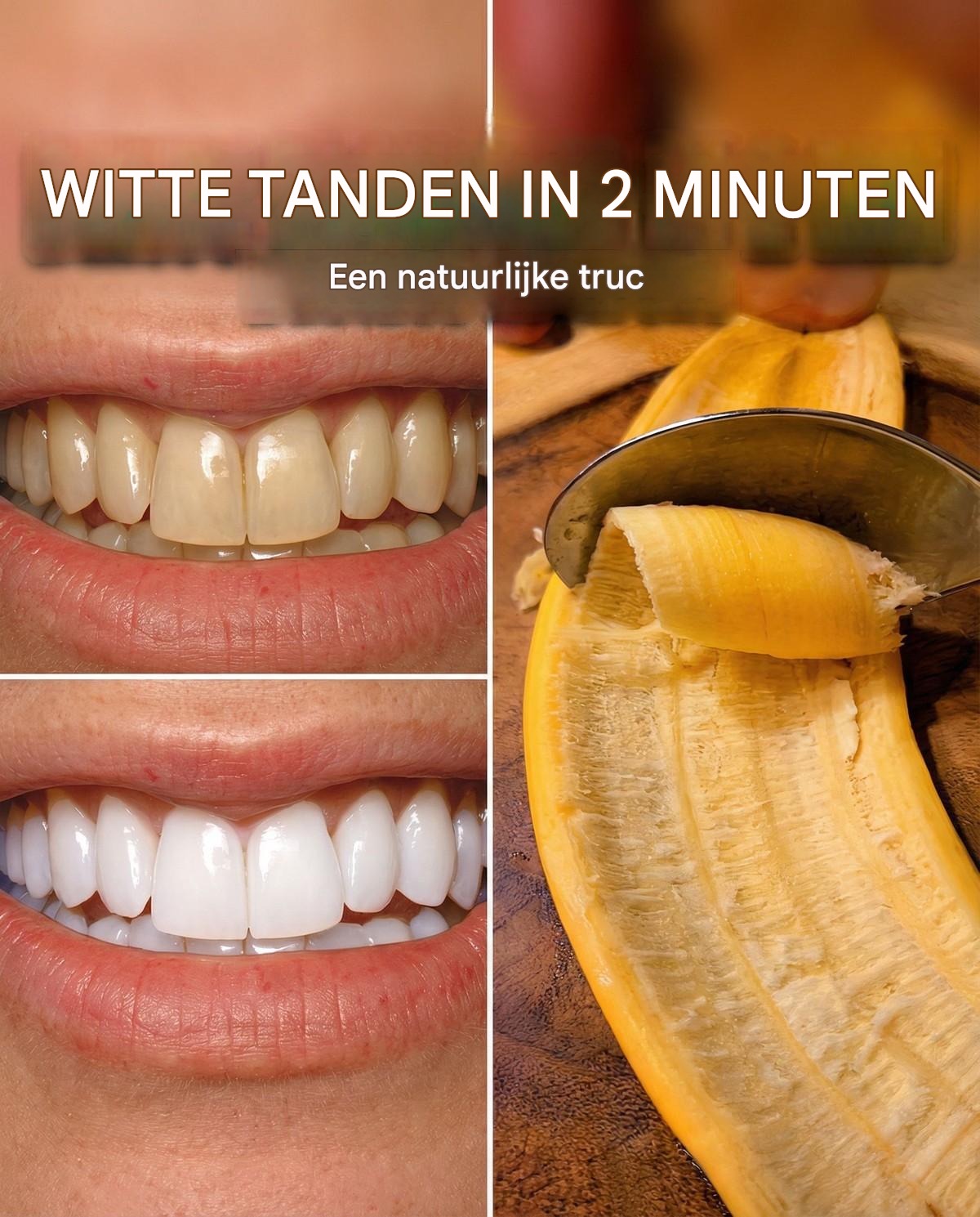 Des dentistes secrets que vous préféreriez ne pas rencontrer : éliminent le tartre et blanchissent vos dents en seulement 2 minutes.