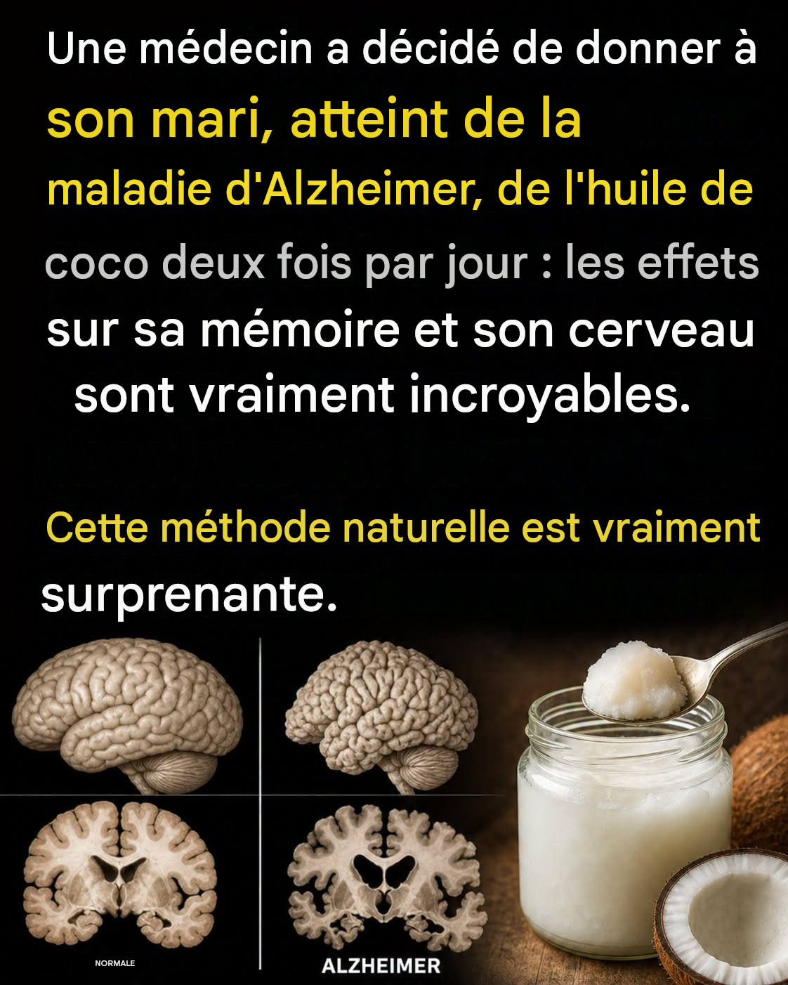 Il a mangé 2 cuillères à soupe d’huile de coco deux fois par jour pendant 60 jours, et voilà ce qui est arrivé à son cerveau !